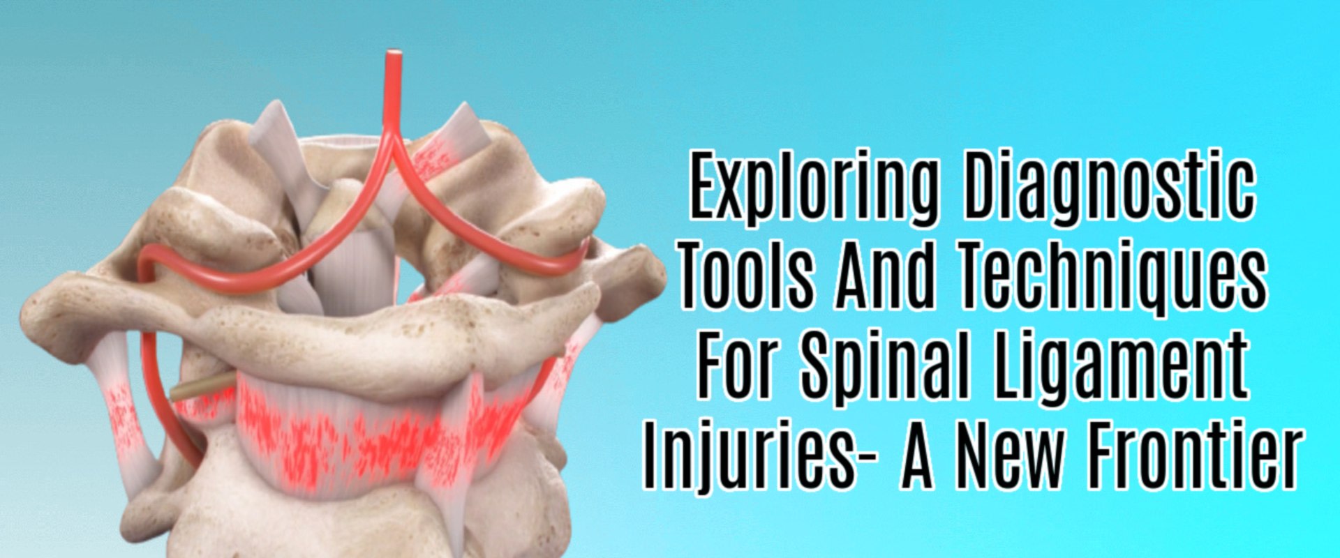 A New Frontier For Spinal Ligament Injury Diagnosis
