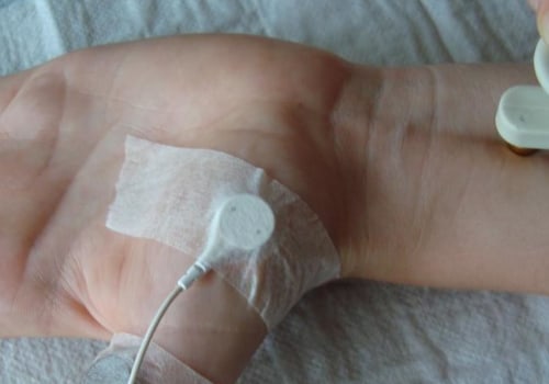 Understanding Spinal Stenosis and Its Causes